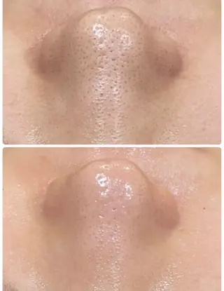 エステ矢野 ジョアアンジェ心斎橋のエステ・リラクイメージ