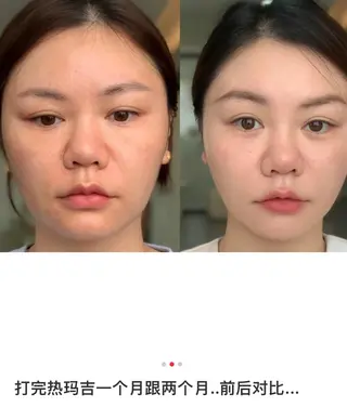 マツエク・マツパ aliaハイフ&水光ジェットサロン所属・aliaハーブ水光店 エステティシャン募集のエステ・リラクイメージ