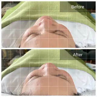 脳休ヘッド ストレッチのエステ・リラクイメージ