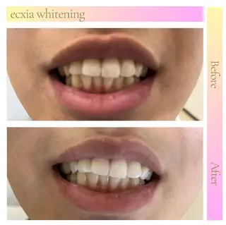 ecxia  white 　広島袋町店所属・セルフホワイトニング エクシア広島袋町店のその他イメージ