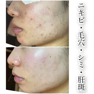 ツヤ肌・美肌サロン (エコル　フル)のエステ・リラクイメージ