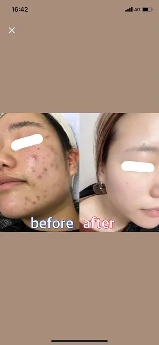 🏳️‍🌈 CHIYAKAのエステ・リラクイメージ