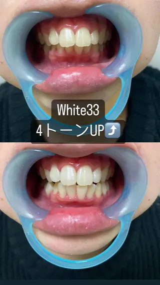 メンズ セルフホワイトニング White33大名のその他イメージ
