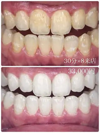 【歯科提携】柏ホワイ トニングスタイルのその他イメージ