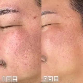 mone~total care salon~所属・mone (モーネ)のエステ・リラクイメージ