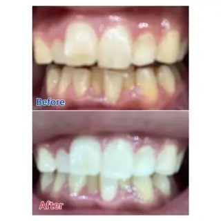 M渋谷 ホワイトニングのエステ・リラクイメージ