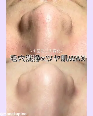 Diailes 💎ななのエステ・リラクイメージ