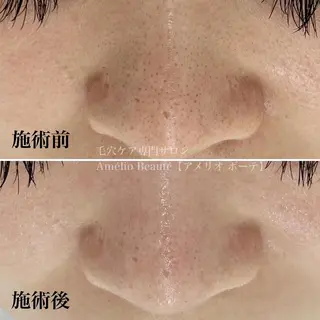 毛穴ケア専門サロン アメリオボーテのその他イメージ