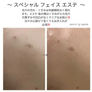 マツエク・マツパ ビューティー ミロワールのエステ・リラクイメージ