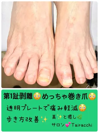 ネイル Tairacchi タイラッチのネイルデザイン