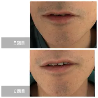 メンズ エマニエル USAのエステ・リラクイメージ