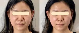 マツエク・マツパ 愛維美水光美肌専門店 メンズレディースokのエステ・リラクイメージ