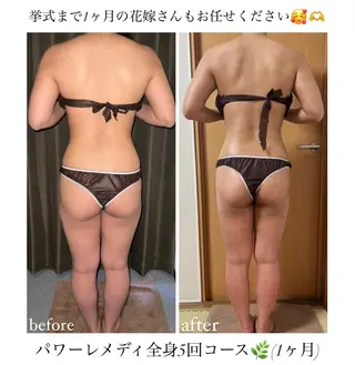 《本気痩せ×疲労改善 》  BILOOPのエステ・リラクイメージ