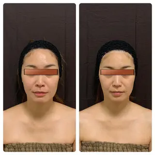 あるる所属・韓国式小顔矯正 担当ゆいのエステ・リラクイメージ