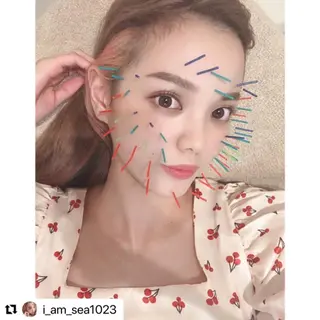 鍼灸 Refineのその他イメージ