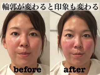 肌質改善×美容鍼 ゆいのエステ・リラクイメージ