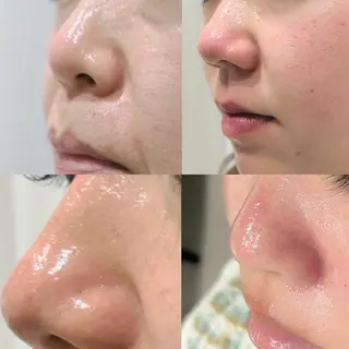 毛穴に特化したサロン MYFAIRLADYのエステ・リラクイメージ