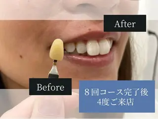 ホワイトニングカフェ荻窪店所属・ホワイトニングカフェ 荻窪店のその他イメージ