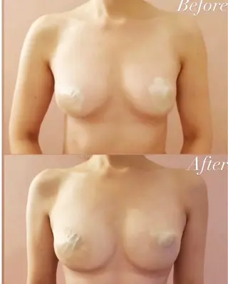 最新育乳マシン使用！ バストアップ専門店のその他イメージ