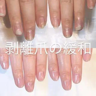 ネイル 自爪育成・巻き爪 補正講師　津蔵のネイルデザイン