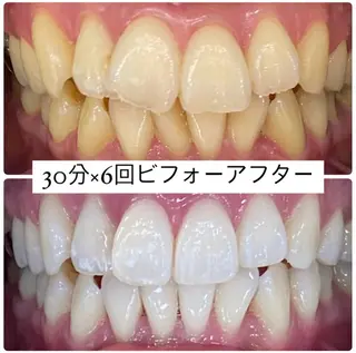 ホワイトニングルーム 横浜店のその他イメージ