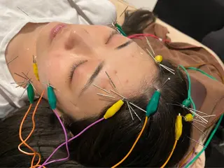 小顔矯/美容鍼/鍼灸 BeauJuのその他イメージ