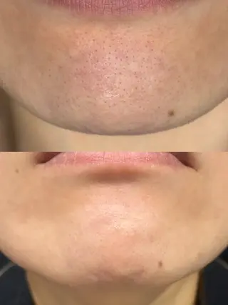 Dahlia痩身脱毛 フェイシャル 中村のエステ・リラクイメージ