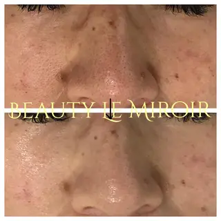 ビューティー ミロワールのエステ・リラクイメージ