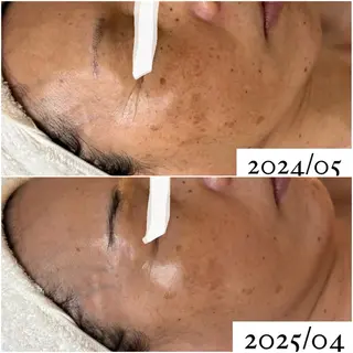 肌質ケアFor... 天王寺店 みほのエステ・リラクイメージ