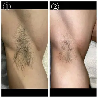 メンズ メンズ脱毛サロン X(エックス)のエステ・リラクイメージ