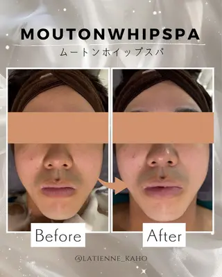 メンズ latienne kahoのエステ・リラクイメージ