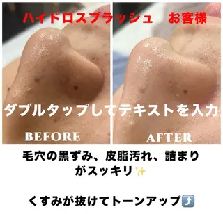 ネイル・エステサロン UILANIのネイルデザイン