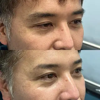 アイブロウ 男眉salon On Fleek!銀座店所属・鈴木 真奈の眉毛・アイブロウイメージ