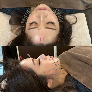 美容鍼サロンAcutyアキュティ吉祥寺所属・橋爪 弘樹のその他イメージ