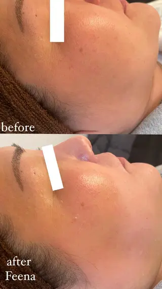 amu nail. RINAのネイルデザイン