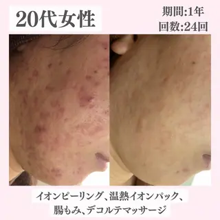 ニキビ・肌質改善専門 ♡人生が変わるサロンのエステ・リラクイメージ