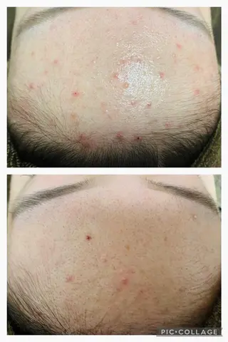 朝重い人専用 肩甲骨調整のエステ・リラクイメージ