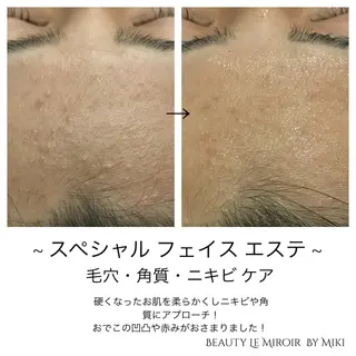 ビューティー ミロワールのエステ・リラクイメージ
