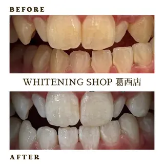 メンズ ホワイトニング ショップ葛西店のその他イメージ