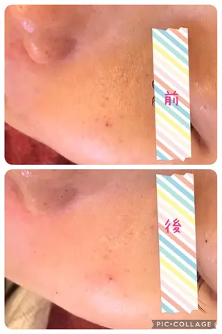 y.laBelle 艶肌・小顔・肌質改善のエステ・リラクイメージ