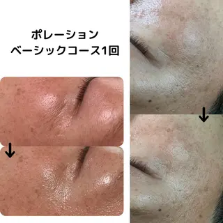 ミューズエステ 谷口美結のエステ・リラクイメージ