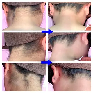 癒処 momiis 鍼灸院のエステ・リラクイメージ