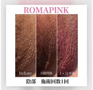 レティティア【Laetitia】所属・レティティア秋葉原店 Yoshizawaのエステ・リラクイメージ