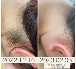 classynail beautyのエステ・リラクイメージ