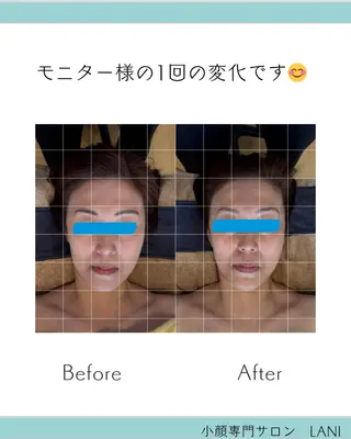 LANI所属・小顔専門サロン MAIのエステ・リラクイメージ