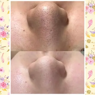 Mixture~ミクスチャー~所属・バスト·毛穴サロン Mixtureのエステ・リラクイメージ