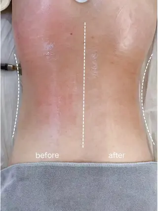 韓国式肌管理＆毛穴洗浄　THE ONE栄店所属・Theone 福本のエステ・リラクイメージ