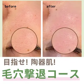 leolo武蔵浦和 肌質改善&脱毛のエステ・リラクイメージ