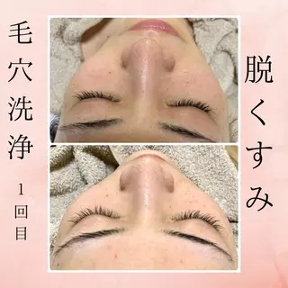 リラクゼーションエステサロン🌺肌質改善イアリイ所属・肌質再生 〜イア🌺リイ〜のエステ・リラクイメージ