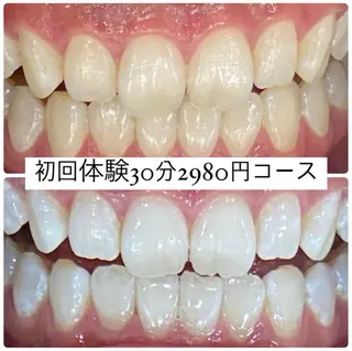 ホワイトニングルーム 横浜店のその他イメージ
